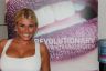Billie From TOWIE Teeth Whitening Treatment By Lovelite White