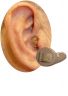 mini canal in ear with mini canal